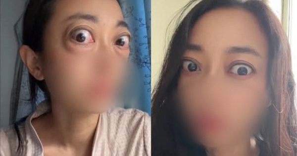 Nhìn đôi mắt 
