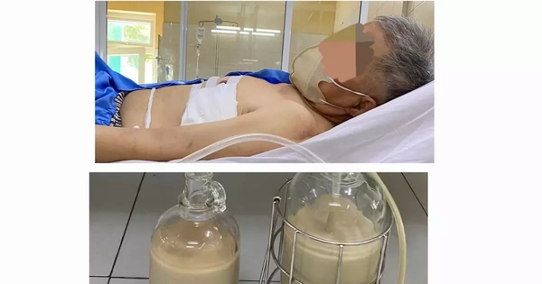 Hút ra hàng lít mủ từ phổi người đàn ông ở Đà Nẵng