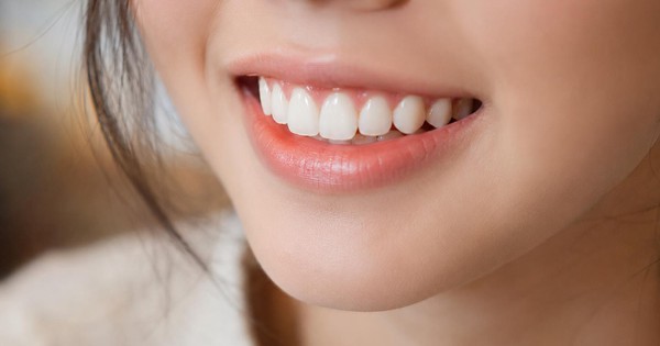 Thăng hạng visual từ nụ cười: Tọa độ "chữa lành" c