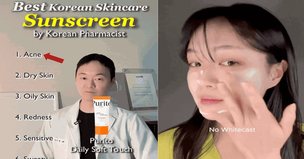 6 tuýp kem được chuyên gia da liễu Hàn Quốc đánh giá cao