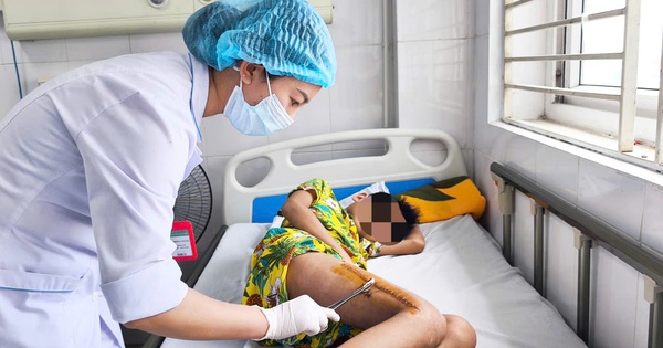 Bé trai 11 tuổi suýt mất chân vì 1 loại vi khuẩn được ví là 