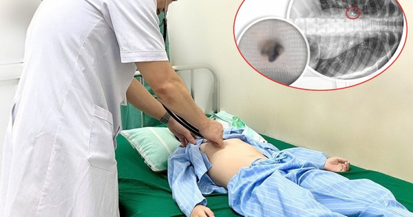 Bé trai 9 tuổi suýt tắc đường thở chỉ vì mẹ tự nhổ răng cho 