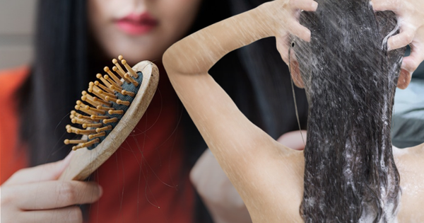 Gội đầu kiểu này cực hại da đầu lại dễ gây hói: Đáng tiếc nh