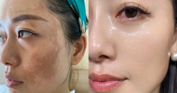 Phụ nữ ngoài 40 đang truyền nhau kiểu dưỡng da mặt