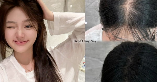 5 dầu gội ngừa rụng tóc "made in Vietnam" rất lành tính dành