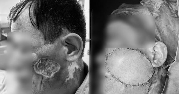 Bác sĩ Bệnh viện Bệnh Nhiệt đới Trung ương cảnh bá