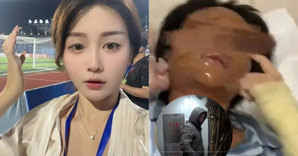 Nữ streamer xinh đẹp bị “hủy dung” sau khi mở gói 