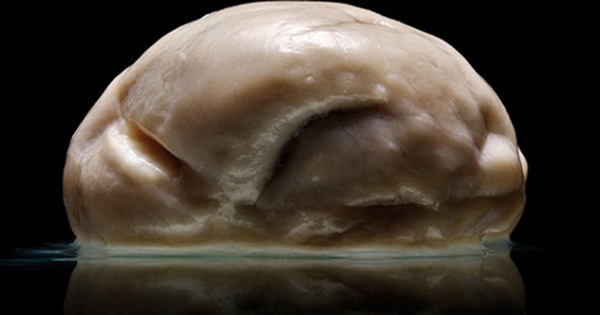 Bộ não, não phẳng, não không có nếp gấp, rãnh, bộ não