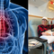 Mỹ phê duyệt thuốc điều trị ung thư phổi giá gần 20 tỷ đồng