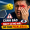 Cảnh báo nguy cơ mù mắt do chơi pickleball
