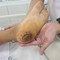 Bệnh viện Bạch Mai cảnh báo: Nhiều người đang phải nhập viện thở máy vì 1 căn bệnh do chủ quan vết thương nhỏ