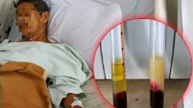 4 người một nhà cùng bị ngộ độc formaldehyde, nguyên nhân từ đồ nội thất  nhà nào cũng có