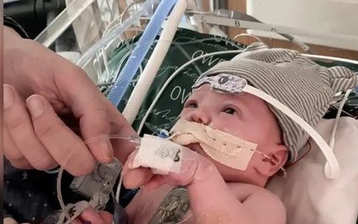 Thông tin mới nhất về em bé được ghép tim đầu tiên trên thế giới