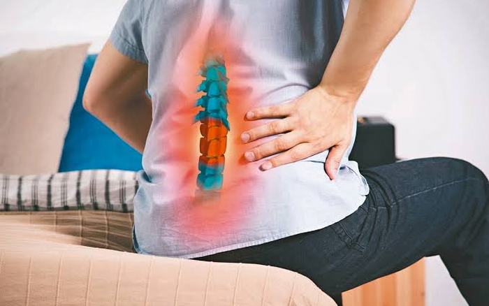 Uống thuốc cúm mãi không khỏi, người đàn ông đi khám phát hiện đốt sống bị vi khuẩn phá hủy